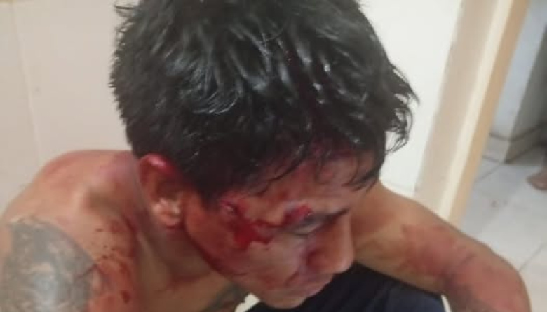 🚨 BRUTAL GOLPIZA AL "GONCHY" CUARTETERO EN EL SUR DE LA CAPITAL